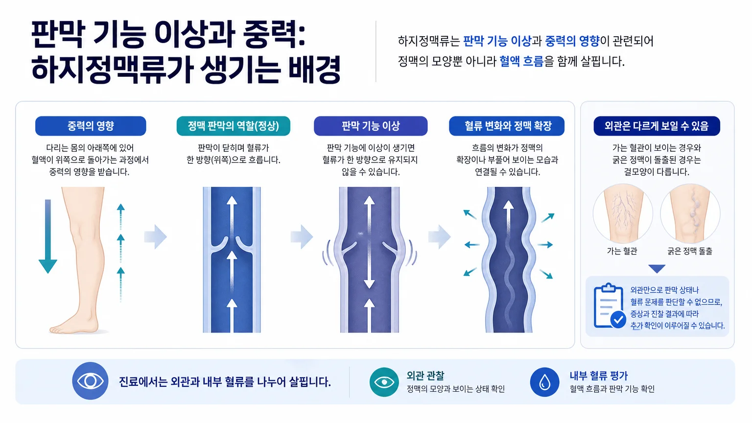 중력과 정맥 판막 기능 이상, 혈류 역류 여부의 관계를 설명한 그림